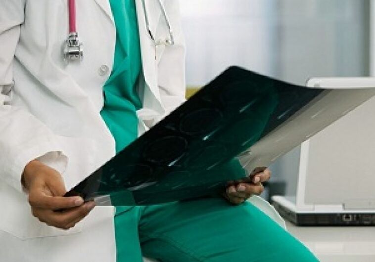 La radiografia aiuterà il medico a diagnosticare l'osteocondrosi della colonna vertebrale toracica