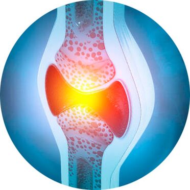 processo di ripristino articolare con gel Icexin